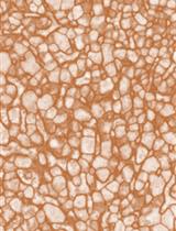 Semi-quantitative Determination of Protein Expression Using Immunohistochemistry Staining and Analysis: An Integrated Protocol
