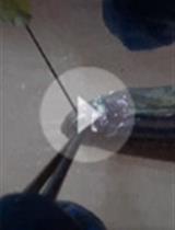 Retina Injury and Retina Tissue Preparation to Study Regeneration in Zebrafish