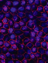 In vitro Differentiation of Human iPSC-derived Retinal Pigment Epithelium Cells (iPSC-RPE)