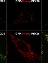 Lysosome Targeting RedGreen-assay: Selective Autophagy Sensing Assay for Mammalian Cells