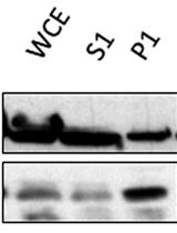A Yeast Chromatin-enriched Fractions Purification Approach,  yChEFs, from Saccharomyces cerevisiae