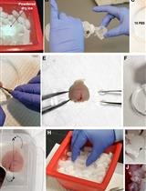 Laser Capture Micro-dissection (LCM) of Neonatal Mouse Forebrain for RNA Isolation
