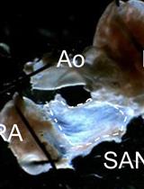 Acute Isolation of Cells from Murine Sino-atrial Node