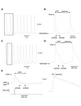 Whole-cell and Perforated Patch-clamp Recordings from Acutely-isolated Murine Sino-atrial Node Cells