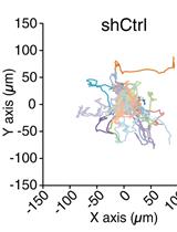 Analysis of Random Migration of Cancer Cells in 3D