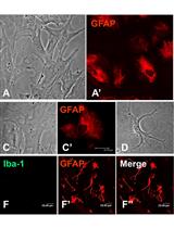 一种简单有效的大鼠脊髓星形胶质细胞和小胶质细胞联合分离培养方法