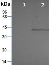 A Radioactive-free Kinase Inhibitor Discovery Assay Against the Trypanosoma brucei Glycogen Synthase Kinase-3 short (TbGSK-3s)