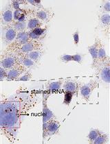 Detection of Individual RNA in Fixed Cells and Tissues by Chromogenic ISH