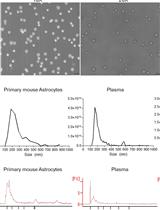 Rapid Nickel-based Isolation of Extracellular Vesicles from Different Biological Fluids