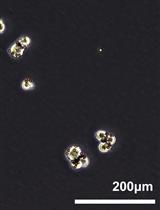 Isolation of Stem Cells, Endothelial Cells and Pericytes from Human Infantile Hemangioma