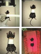 Skin Transplantation and Lymphoid Organ Analysis in Mice