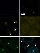 Super-resolution Microscopy-based Bimolecular Fluorescence Complementation to Study Protein Complex Assembly and Co-localization
