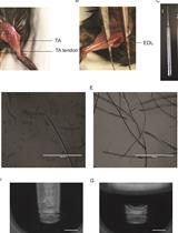 RNA Sequencing of Single Myofibers from Mus musculus
