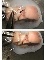 大鼠脉络丛原代上皮细胞培养方法