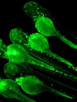 Zebrafish Bacterial Infection Assay to Study Host-Pathogen Interactions