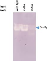 Manganese Superoxide Dismutase Activity Assay in the Yeast Saccharomyces cerevisiae