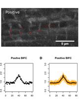 Bimolecular Fluorescence Complementation (BiFC) for Studying Sarcomeric Protein Interactions in Drosophila