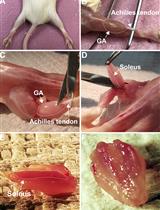 Isolation, Purification and Characterization of Exosomes from Fibroblast Cultures of Skeletal Muscle