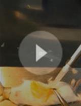 利用A549肺癌细胞进行肿瘤生长和自发性转移的体内检测