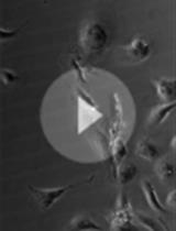 Single Cell Migration Assay Using Human Breast Cancer MDA-MB-231 Cell Line
