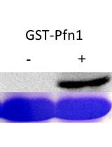 An <em>in vitro</em> Assay to Screen for Substrates of PKA Using Phospho-motif-specific Antibodies 