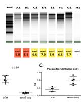 Circadian Gene Profiling in Laser Capture Microdissected Mouse Club Cells