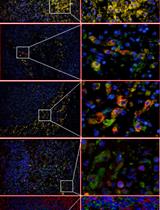 Detection of the SARS-CoV-2 Nucleocaspid Protein (NP) Using Immunohistochemistry