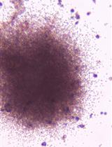 A Modified Semisolid Clonal Culture for Identification of B-1 and B-2 Progenitor Colony Forming Ability of Mouse Embryonic Hemogenic Endothelial Cells