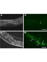 Quantification of Bacteria Residing in Caenorhabditis elegans Intestine