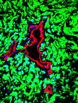 Isolation of Tumor Cells Based on Their Distance from Blood Vessels