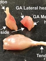 Analysis of Generalized Fibrosis in Mouse Tissue Sections with Masson’s Trichrome Staining