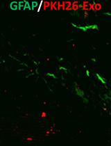 Extracellular Vesicles Tracking and Quantification Using CT and Optical Imaging in Rats