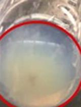 用柠檬酸钠和差速超速离心分离牛乳中多个含外泌体和膜囊泡的胞外小泡亚群