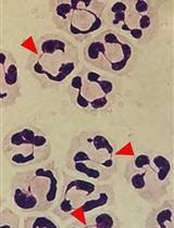 Isolation and High Throughput Flow Cytometric Apoptosis Assay of Human Neutrophils to Enable Compound Library Screening