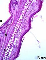 RNA Extraction from Ears and Draining Lymph Nodes of Mice Infected with Leishmania amazonensis