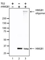 In vitro Crosslinking Reactions and Substrate Incorporation Assays for The Identification of Transglutaminase-2 Protein Substrates