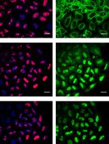 Quantitative Nucleocytoplasmic Transport Assays in Cellular Models of Neurodegeneration