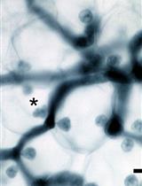 Maintenance and Quantitative Phenotyping of the Oomycete-plant Model Pathosystem Hyaloperonospora arabidopsidis–Arabidopsis