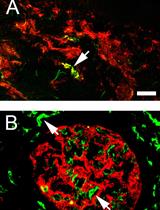 Co-immunostaining of ICAM-1, ICAM-2, and CD31 in Mouse Kidney Glomeruli