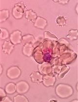 Microscopy-based Methods for Rosetting Assay in Malaria Research