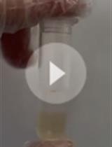 小鼠粪便中短链脂肪酸的气相色谱检测