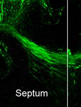 Organotypic Slice Culture of the Embryonic Mouse Brain