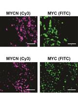 Tyramide Signal-Amplified Immunofluorescence of MYCN and MYC in Human Tissue Specimens and Cell Line Cultures