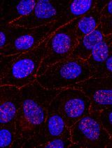 Immunofluorescent Staining of Claudin-2 in Cultured Kidney Tubular Cells