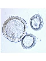 Intestinal Enteroid Culture for Human Astroviruses