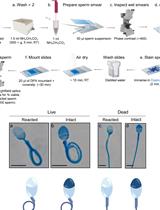 In vitro Induction and Detection of Acrosomal Exocytosis in Human Spermatozoa