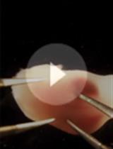 Mechanical Tissue Compression and Whole-mount Imaging at Single Cell Resolution for Developing Murine Epididymal Tubules