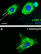 Measuring Intracellular Vesicle Density and Dispersion  Using Fluorescence Microscopy and ImageJ/FIJI