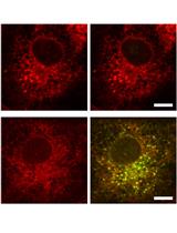 A Quantitative Single-cell Flow Cytometry Assay for Retrograde Membrane Trafficking Using Engineered Cholera Toxin