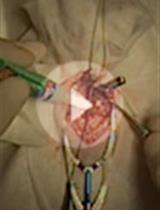 醋酸脱氧皮质酮盐型高血压大鼠模型的建立